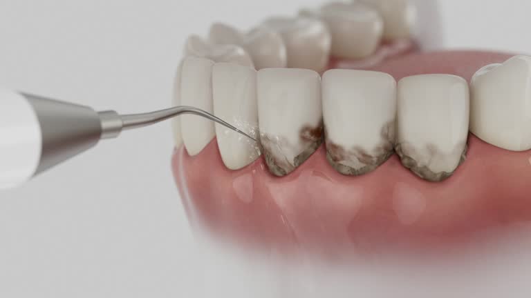 Reliable Dental Implants contractor in Ruleville, MS by Smile Center Dentistry